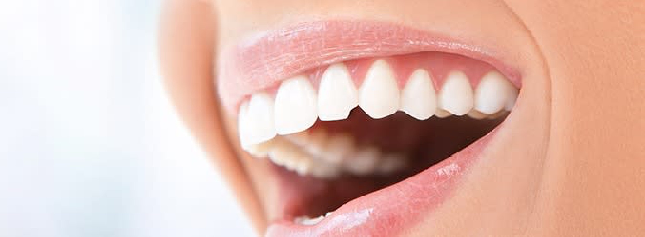 How to fix a chipped tooth?